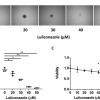 Antifungal Agent Luliconazole Inhibits the Growth of Mouse Glioma-initiating Cells in Brain Explants [Published online in advanced , by J-STAGE]