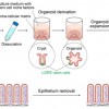 <i>In Vivo</i> Intestinal Research Using Organoid Transplantation [Published online Keio J Med, 71, 73-81, by J-STAGE]