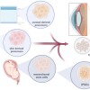 The Cornea: An Ideal Tissue for Regenerative Medicine [Published online Keio J Med, 73, 1-7, by J-STAGE]